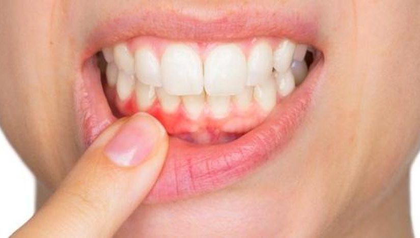 چگونه تشخیص دهیم که دندان عفونی شده است؟