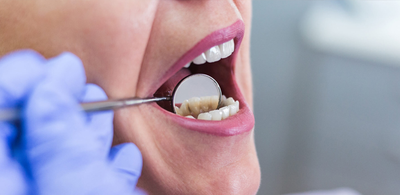 درمان ترمیمی دندان چیست – Smyrna Dent