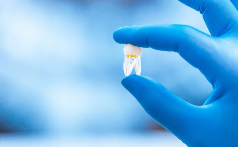علائم تاج دندان نامناسب: راه حل ها و جایگزین ها