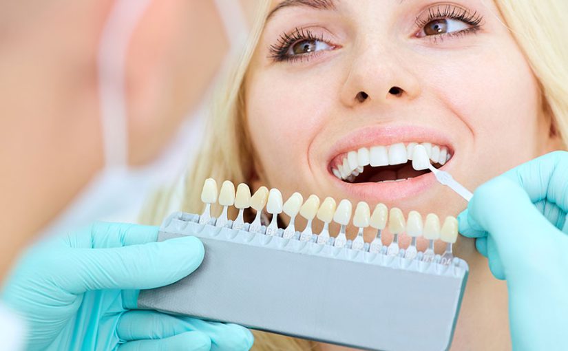 انواع روکش دندان چیست؟  – Smyrna Dent