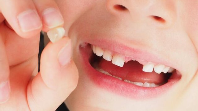شیر دندان چیست؟  – Smyrna Dent