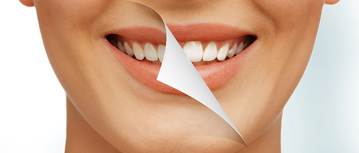 سفید کردن دندان چگونه ساخته می شود؟  – Smyrna Dent