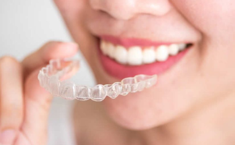تمیز کردن دندان در درمان پلاک شفاف چگونه باید باشد؟
