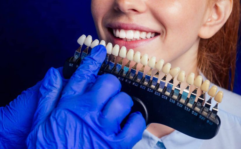 ¿Qué son las coronas dentales y cuando son necesarias?