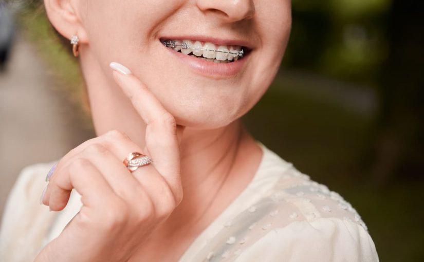 ¿Qué tipos de ortodoncias existen? ¿Cúal elegir?